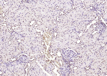 Phospho-SRF (Ser77) Rabbit Polyclonal Antibody
