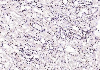 Phospho-SRF (Ser77) Rabbit Polyclonal Antibody