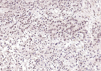 Phospho-SRF (Ser77) Rabbit Polyclonal Antibody