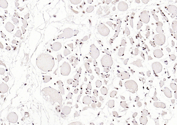 Phospho-SRF (Ser77) Rabbit Polyclonal Antibody