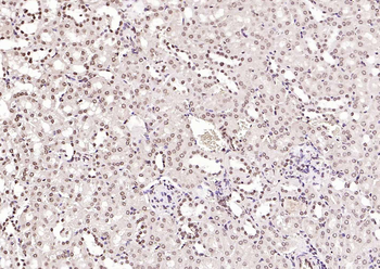 Phospho-SRF (Ser77) Rabbit Polyclonal Antibody