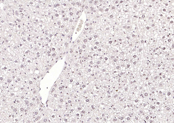Phospho-SRF (Ser77) Rabbit Polyclonal Antibody