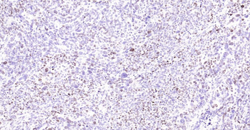 Ki67 Recombinant Rabbit Monoclonal Antibody