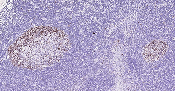 Ki67 Recombinant Rabbit Monoclonal Antibody