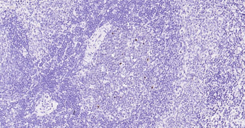 Ki67 Recombinant Rabbit Monoclonal Antibody