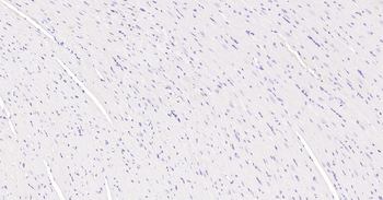 Ki67 Recombinant Rabbit Monoclonal Antibody