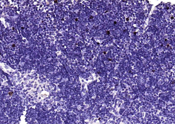 Ki67 Recombinant Rabbit Monoclonal Antibody