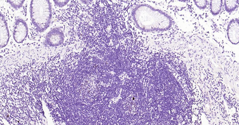 Ki67 Recombinant Rabbit Monoclonal Antibody