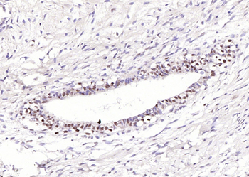 FTO Recombinant Rabbit Monoclonal Antibody