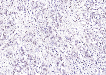 FTO Recombinant Rabbit Monoclonal Antibody