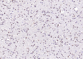 FTO Recombinant Rabbit Monoclonal Antibody
