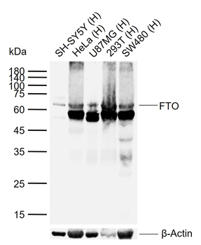 FTO Recombinant Rabbit Monoclonal Antibody