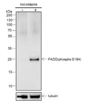 Phospho-FADD (Ser194) Recombinant Rabbit Monoclonal Antibody
