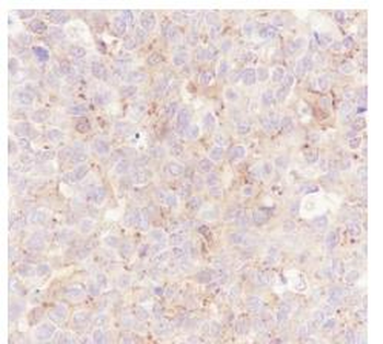 PDCD6IP Recombinant Rabbit Monoclonal Antibody