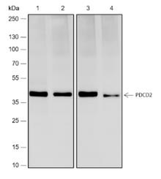 PDCD2 Recombinant Rabbit Monoclonal Antibody