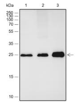 CALB1 Recombinant Rabbit Monoclonal Antibody