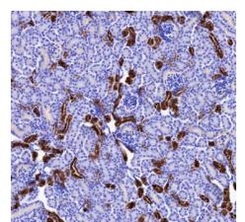 CALB1 Recombinant Rabbit Monoclonal Antibody