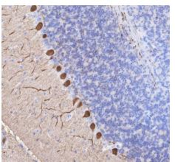CALB1 Recombinant Rabbit Monoclonal Antibody