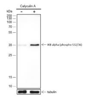 Phospho-IKB Alpha (Ser32 / Ser36) Recombinant Rabbit Monoclonal Antibody