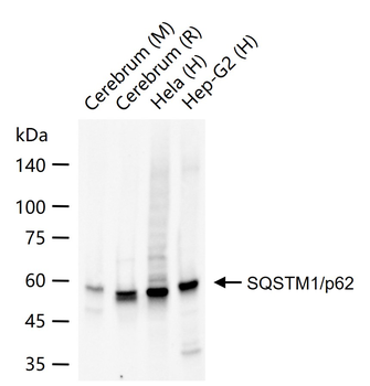 SQSTM1/p62 Recombinant Rabbit Monoclonal Antibody