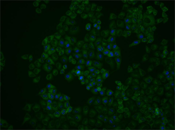 SQSTM1/p62 Recombinant Rabbit Monoclonal Antibody