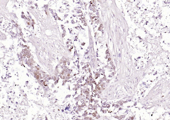 SQSTM1/p62 Recombinant Rabbit Monoclonal Antibody