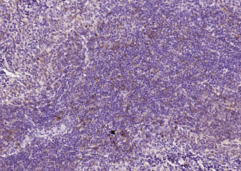 SQSTM1/p62 Recombinant Rabbit Monoclonal Antibody