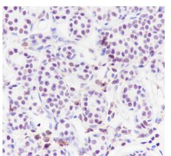 CHD3 Recombinant Rabbit Monoclonal Antibody