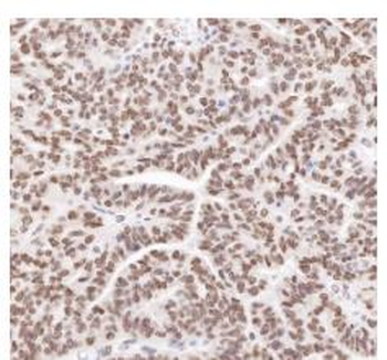 APEX1 Recombinant Rabbit Monoclonal Antibody