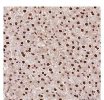 APEX1 Recombinant Rabbit Monoclonal Antibody