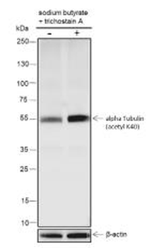 Alpha Tubulin (Acetyl-Lys40) Recombinant Rabbit Monoclonal Antibody
