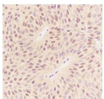 RBX1 Recombinant Rabbit Monoclonal Antibody