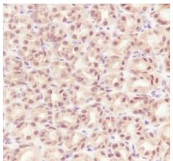 RBX1 Recombinant Rabbit Monoclonal Antibody