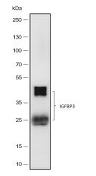 IGFBP3 Recombinant Rabbit Monoclonal Antibody