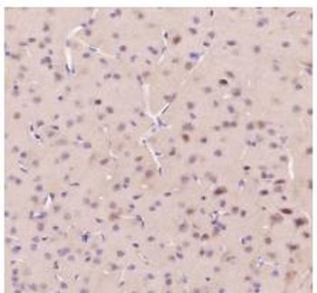 AKT1 / AKT2 / AKT3 Recombinant Rabbit Monoclonal Antibody