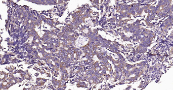 PTP1B Recombinant Rabbit Monoclonal Antibody