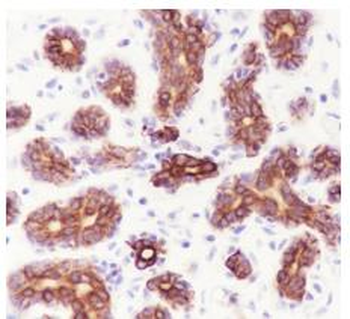 CK18 Recombinant Rabbit Monoclonal Antibody