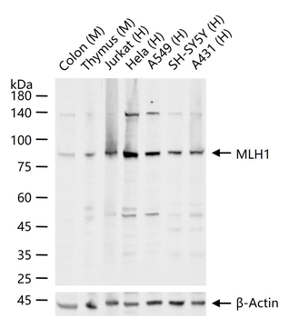 MLH1 Recombinant Rabbit Monoclonal Antibody