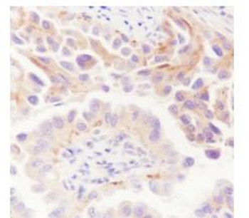 ATG9A Recombinant Rabbit Monoclonal Antibody