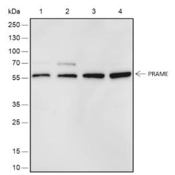 PRAME Recombinant Rabbit Monoclonal Antibody