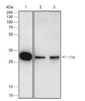 C1QA Recombinant Rabbit Monoclonal Antibody