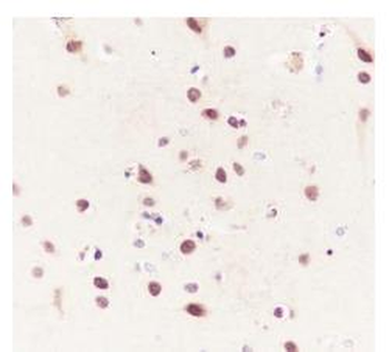 CBX4 Recombinant Rabbit Monoclonal Antibody