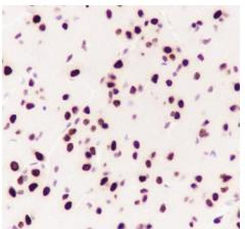 CBX4 Recombinant Rabbit Monoclonal Antibody