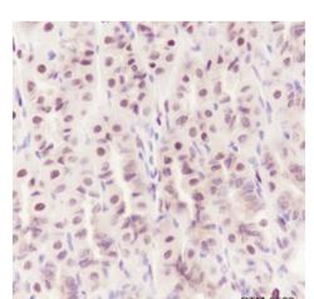 CBX4 Recombinant Rabbit Monoclonal Antibody