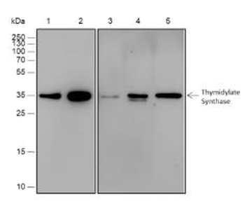 TYMS Recombinant Rabbit Monoclonal Antibody