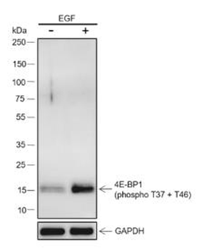 Phospho-eIF4EBP1 (Thr37 / Thr46) Recombinant Rabbit Monoclonal Antibody