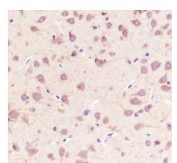 LRP1 Recombinant Rabbit Monoclonal Antibody