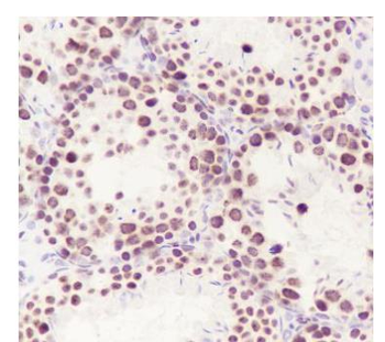 HMGB2 Recombinant Rabbit Monoclonal Antibody