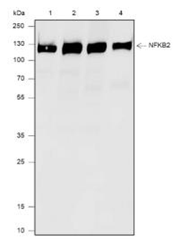 NFKB2 Recombinant Rabbit Monoclonal Antibody