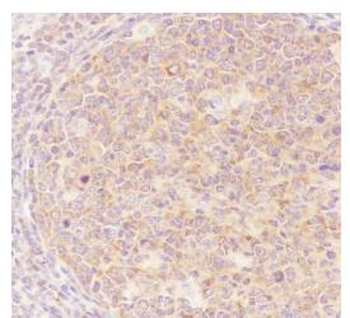 NFKB2 Recombinant Rabbit Monoclonal Antibody